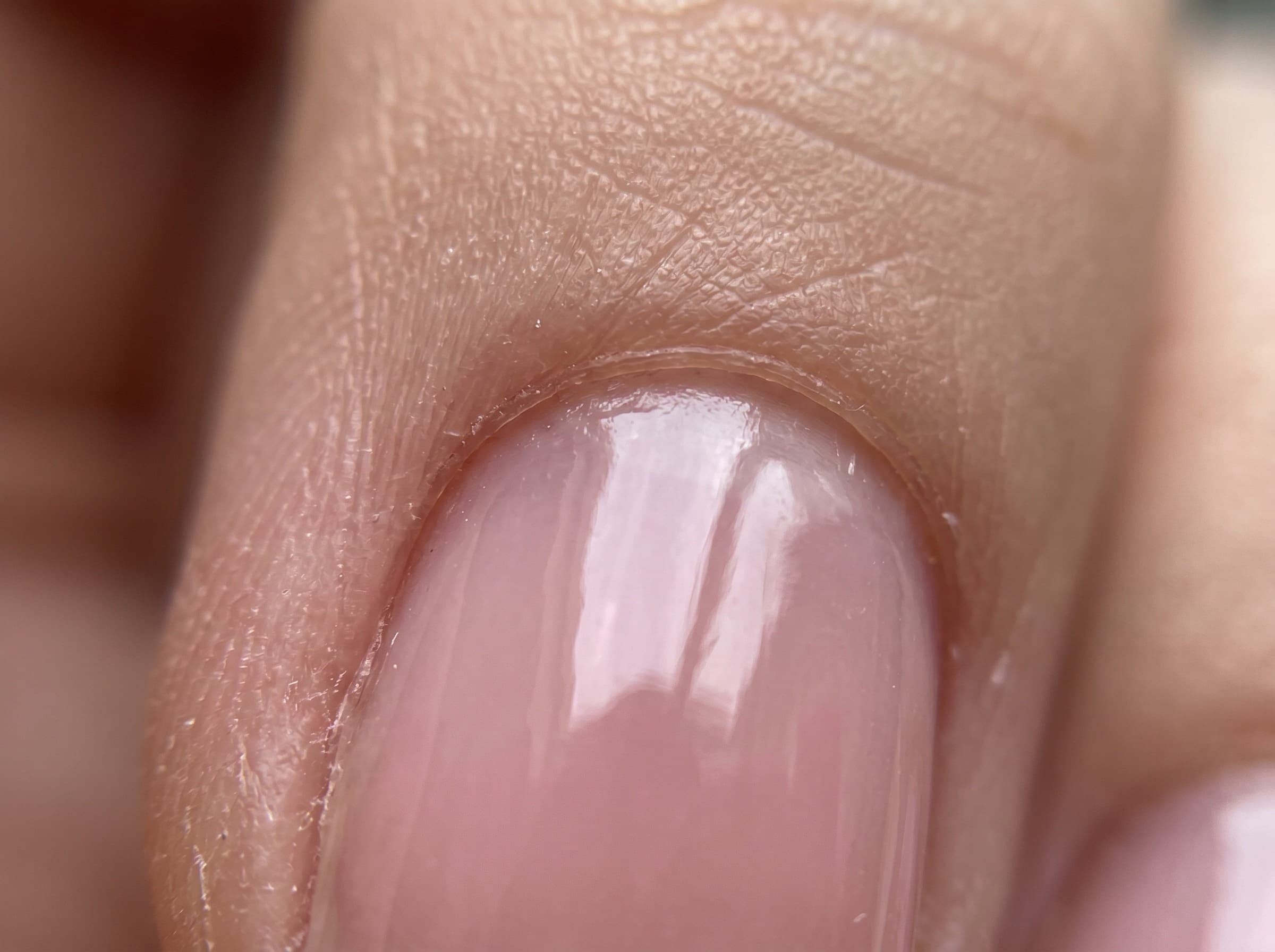 Ultra-macro of a single thumb with a sheer pink gel glossy topcoat showing cuticle texture detail.
